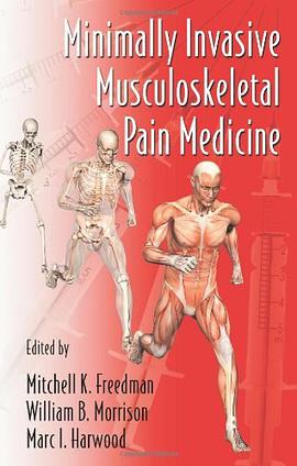 Minimally Invasive Musculoskeletal Pain Medicine pdf epub mobi 下载