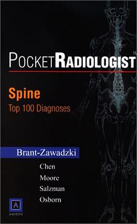Spine 2002 pdf epub mobi 电子书 下载