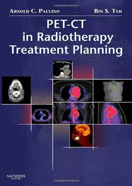 PET-CT in Radiotherapy Treatment Planning pdf epub mobi 电子书 下载