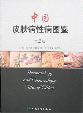 中国皮肤病性病图鉴 pdf epub mobi 电子书 下载