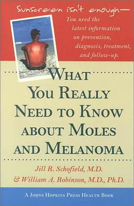 What You Really Need to Know about Moles and Melanoma pdf epub mobi 下载