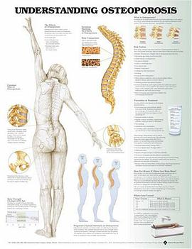 Understanding Osteoporosis Anatomical Chart pdf epub mobi 电子书 下载