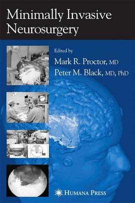 Minimally Invasive Neurosurgery pdf epub mobi 电子书 下载