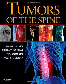 Tumors of the Spine pdf epub mobi 电子书 下载