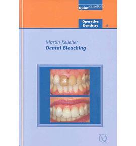 Dental Bleaching pdf epub mobi 电子书 下载