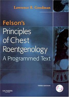 Felson胸部X线原理 pdf epub mobi 电子书 下载