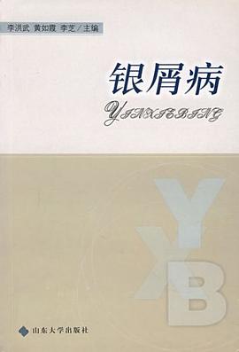 銀屑病 pdf epub mobi 電子書 下載