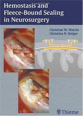 Hemostasis and Fleece-Bound Sealing in Neurosurgery pdf epub mobi 电子书 下载