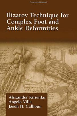 Ilizarov Technique for Complex Foot and Ankle Deformities pdf epub mobi 电子书 下载