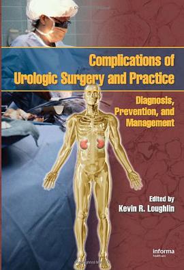 Complications of Urologic Surgery and Practice