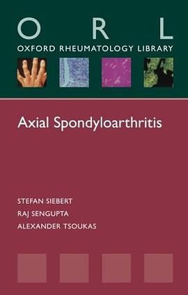 Axial Spondyloarthritis pdf epub mobi 电子书 下载