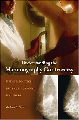 Understanding the Mammography Controversy pdf epub mobi 电子书 下载