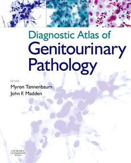 Diagnostic Atlas of Genitourinary Pathology pdf epub mobi 电子书 下载