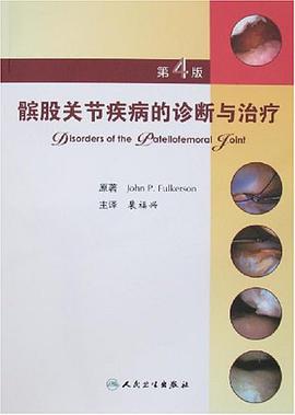 髌股关节疾病的诊断与治疗