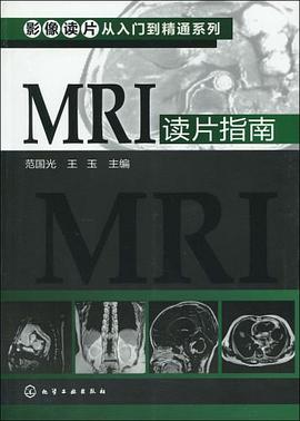 MRI读片指南 pdf epub mobi 电子书 下载