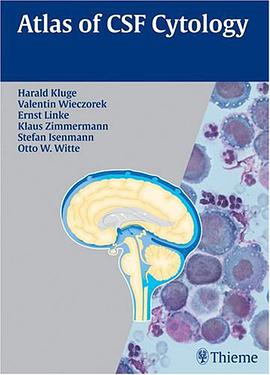 Atlas of CSF Cytology pdf epub mobi 电子书 下载