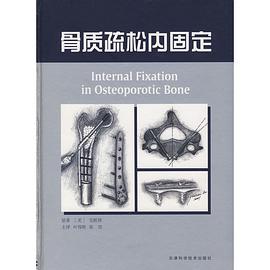 骨质疏松内固定 pdf epub mobi 电子书 下载