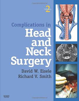 Complications in Head and Neck Surgery with CD Image Bank pdf epub mobi 电子书 下载