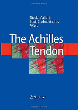 The Achilles Tendon