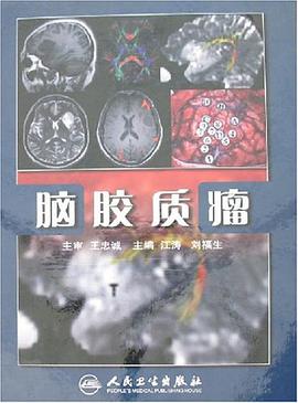 脑胶质瘤 pdf epub mobi 电子书 下载