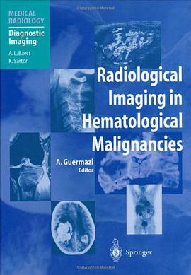 Radiological Imaging in Hematological Malignancies pdf epub mobi 电子书 下载