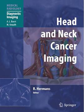 Head and Neck Cancer Imaging pdf epub mobi 电子书 下载
