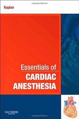 Essentials of Cardiac Anesthesia pdf epub mobi 电子书 下载