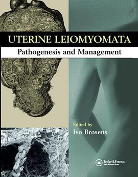 Uterine Leiomyomas pdf epub mobi 电子书 下载