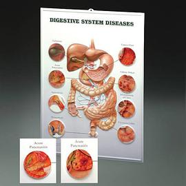 Digestive System Diseases pdf epub mobi 电子书 下载