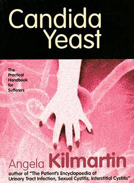 Candida pdf epub mobi 电子书 下载