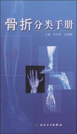 骨折分类手册 pdf epub mobi 电子书 下载