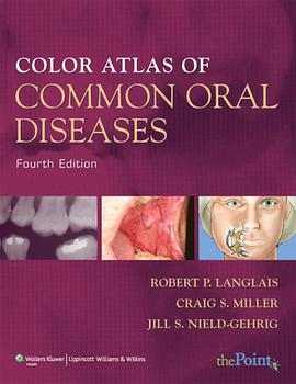 Color Atlas of Common Oral Diseases pdf epub mobi 下载