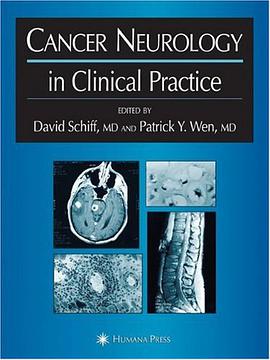 Cancer Neurology in Clinical Practice pdf epub mobi 电子书 下载