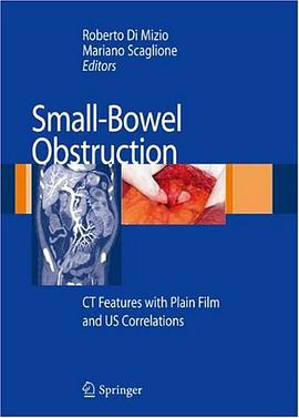 Small Bowel Obstruction