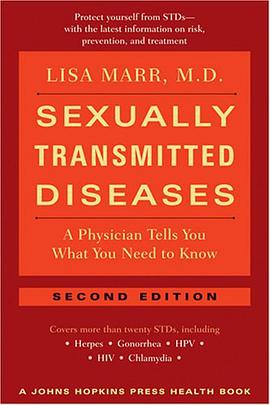 Sexually Transmitted Diseases pdf epub mobi 电子书 下载
