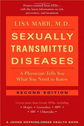 Sexually Transmitted Diseases pdf epub mobi 电子书 下载