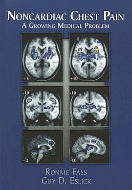 Noncardiac Chest Pain pdf epub mobi 电子书 下载