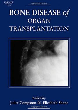 Bone Disease of Organ Transplantation pdf epub mobi 电子书 下载