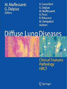Diffuse Lung Diseases pdf epub mobi 电子书 下载