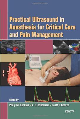Practical Ultrasound in Anesthesia for Critical Care and Pain Management pdf epub mobi 电子书 下载