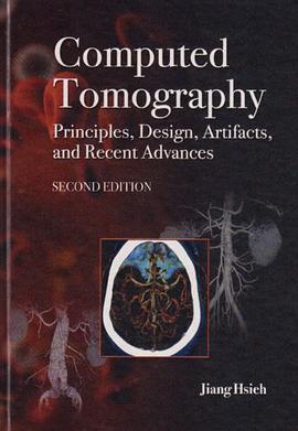 Computed Tomography Principles, Design, Artifacts, and Recent Advances pdf epub mobi 电子书 下载