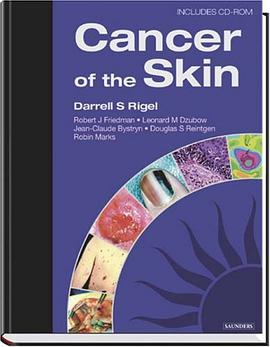 Cancer of the Skin pdf epub mobi 电子书 下载