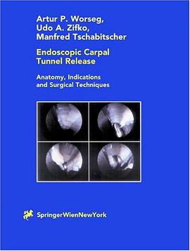 Endoscopic Carpal Tunnel Release pdf epub mobi 电子书 下载
