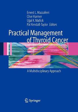 Practical Management of Thyroid Cancer pdf epub mobi 电子书 下载