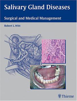Salivary Gland Diseases pdf epub mobi 电子书 下载