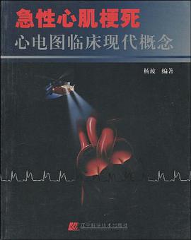 急性心肌梗死心电图临床现代概念 pdf epub mobi 电子书 下载