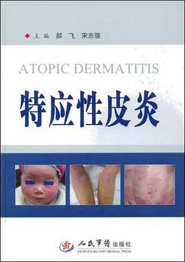 特应性皮炎 pdf epub mobi 电子书 下载