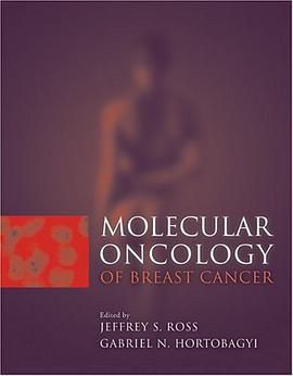 Molecular Oncology of Breast Cancer pdf epub mobi 电子书 下载
