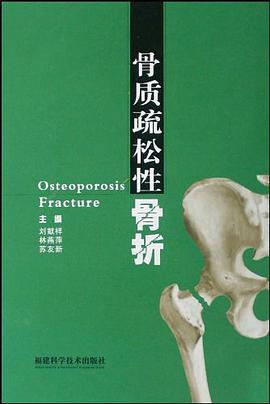 骨質疏鬆性骨摺 pdf epub mobi 電子書 下載