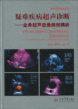 疑难疾病超声诊断 pdf epub mobi 电子书 下载